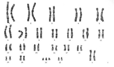 chromosome mutation