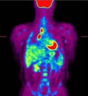 gamma ray image of body